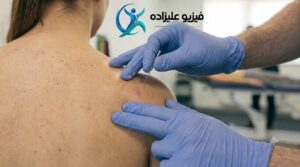 فیزیوتراپی در منزل درای نیدلینگ سوزن خشک